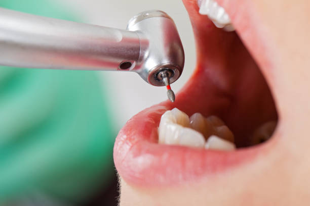 Best Same-Day Emergency Dental Services in Providence Village, TX
